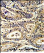 IGFBP6 Antibody in Immunohistochemistry (IHC)