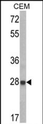 IGFBP6 Antibody in Western Blot (WB)