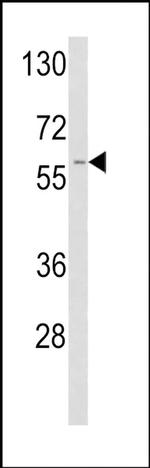 tPA Antibody in Western Blot (WB)