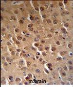 PFTK1 Antibody in Immunohistochemistry (IHC)