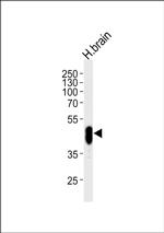 PFTK1 Antibody in Western Blot (WB)