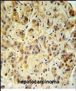 FUCA1 Antibody in Immunohistochemistry (IHC)