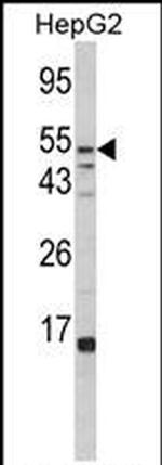 FUCA1 Antibody in Western Blot (WB)