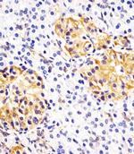 HSPA14 Antibody in Immunohistochemistry (IHC)