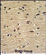 CUEDC2 Antibody in Immunohistochemistry (IHC)