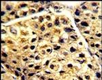 AADAC Antibody in Immunohistochemistry (IHC)