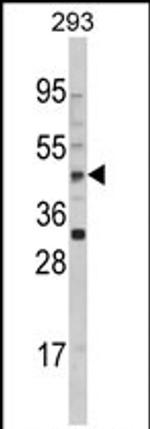 AADAC Antibody in Western Blot (WB)