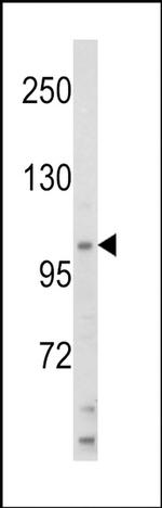 HLTF Antibody in Western Blot (WB)