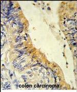 ACADM Antibody in Immunohistochemistry (IHC)
