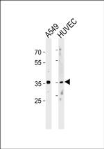 HOXB5 Antibody in Western Blot (WB)