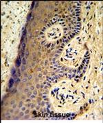 MAFF Antibody in Immunohistochemistry (IHC)
