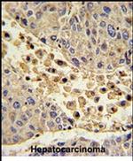 COLEC11 Antibody in Immunohistochemistry (IHC)