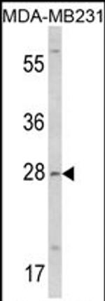 COLEC11 Antibody in Western Blot (WB)