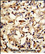 DFNA5 Antibody in Immunohistochemistry (IHC)
