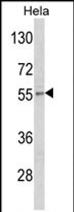 DFNA5 Antibody in Western Blot (WB)