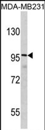 SAPAP1 Antibody in Western Blot (WB)
