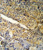 SPINK5 Antibody in Immunohistochemistry (IHC)