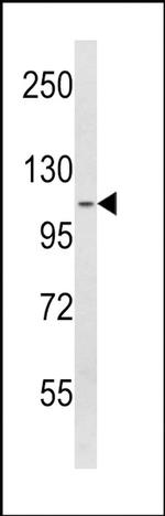 SPINK5 Antibody in Western Blot (WB)