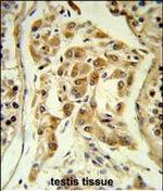 ESPN Polyclonal Antibody