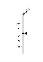 ESPN Antibody in Western Blot (WB)