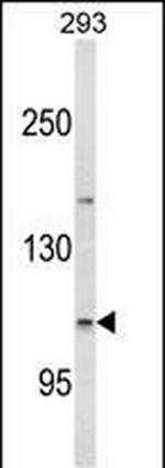 ESPN Antibody in Western Blot (WB)
