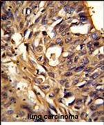 ETFDH Antibody in Immunohistochemistry (IHC)