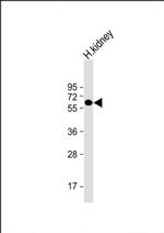 ETFDH Antibody in Western Blot (WB)