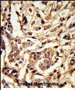 GALT Antibody in Immunohistochemistry (IHC)