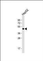 GALT Antibody in Western Blot (WB)