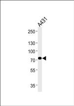 HADHA Antibody in Western Blot (WB)
