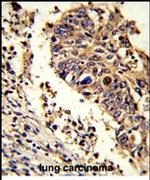 LUC7L Antibody in Immunohistochemistry (IHC)