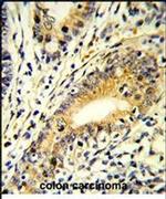 FAM3B Antibody in Immunohistochemistry (IHC)