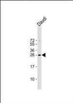 FAM3B Antibody in Western Blot (WB)