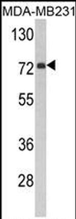 FMO3 Antibody in Western Blot (WB)