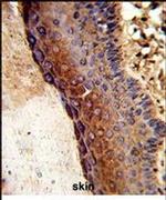 GALE Antibody in Immunohistochemistry (IHC)