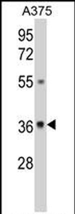 GALE Antibody in Western Blot (WB)