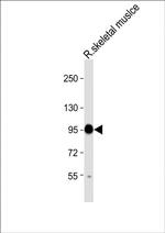 COMP Antibody in Western Blot (WB)