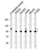 COMP Antibody in Western Blot (WB)