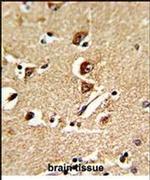 GNPAT Antibody in Immunohistochemistry (IHC)