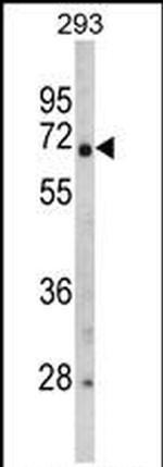 GNPAT Antibody in Western Blot (WB)