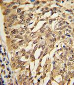 SAR1A Antibody in Immunohistochemistry (IHC)