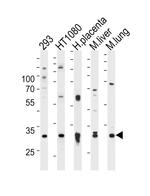 SAR1A Antibody in Western Blot (WB)