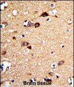 UNC5C Polyclonal Antibody
