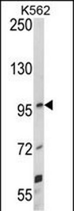 UNC5C Antibody in Western Blot (WB)