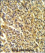 Kir2.1 (KCNJ2) Polyclonal Antibody