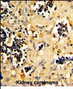 NDUFS4 Antibody in Immunohistochemistry (IHC)