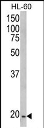 NDUFS4 Antibody in Western Blot (WB)