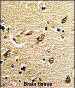 MT-ND5 Polyclonal Antibody