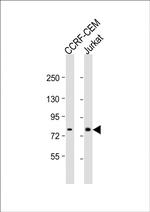 MT-ND5 Antibody in Western Blot (WB)