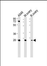 IGFBP4 Antibody in Western Blot (WB)
